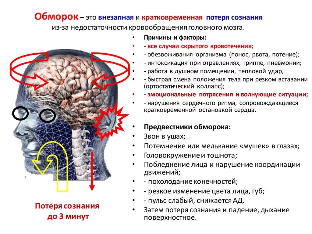 Причины кратковременной потери сознания. Обморок и потеря сознания. Предпосылки обморока. Внезапная потеря сознания.