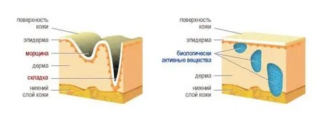 Коллаген подкожно