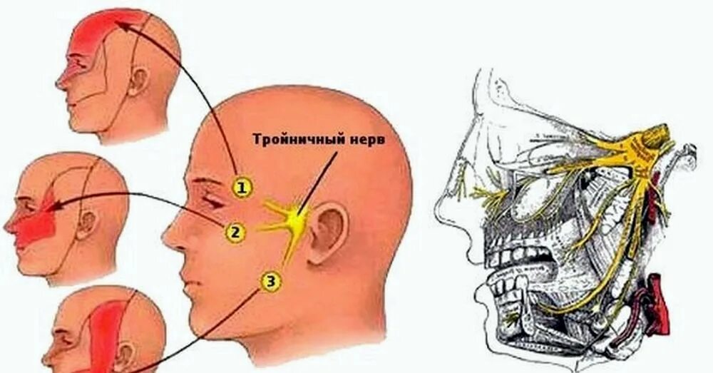 Тянет лоб. Невралгия тройничного нерва 1. Воспаление тройничного лицевого нерва. Поражение ветвей тройничного нерва. Воспаление верхней ветви тройничного нерва.