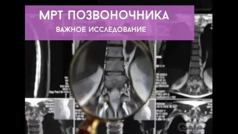 Мрт великие луки