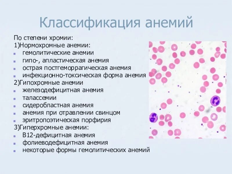 Анемии постгеморрагическая гемолитическая. Классификация анемий острая постгеморрагическая анемия. Анемия постгеморрагическая степени тяжести классификация. Постгеморрагическая анемия ОАК. Постгеморрагическая гипохромная анемия классификация.