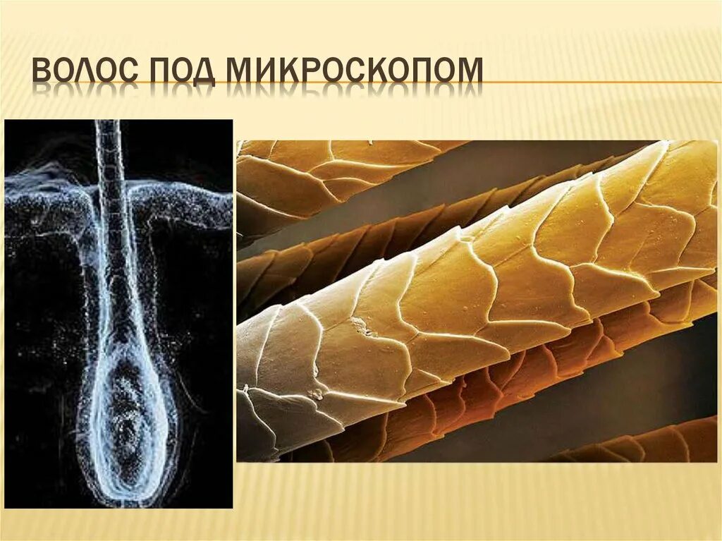 Кортекс волоса под микроскопом. Волос под микроскопом. Волос человека под микроскопом. Структура волоса под микроскопом.