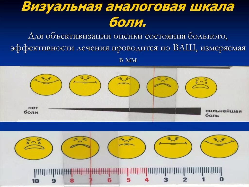 Интенсивность головной боли. Визуально аналоговая шкала ревматоидный артрит. Визуально аналоговая шкала при ревматоидном артрите. Визуальная аналоговая шкала оценки боли. Визуально аналоговая шкала риносинусит.