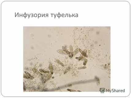 Систематическая группа инфузории