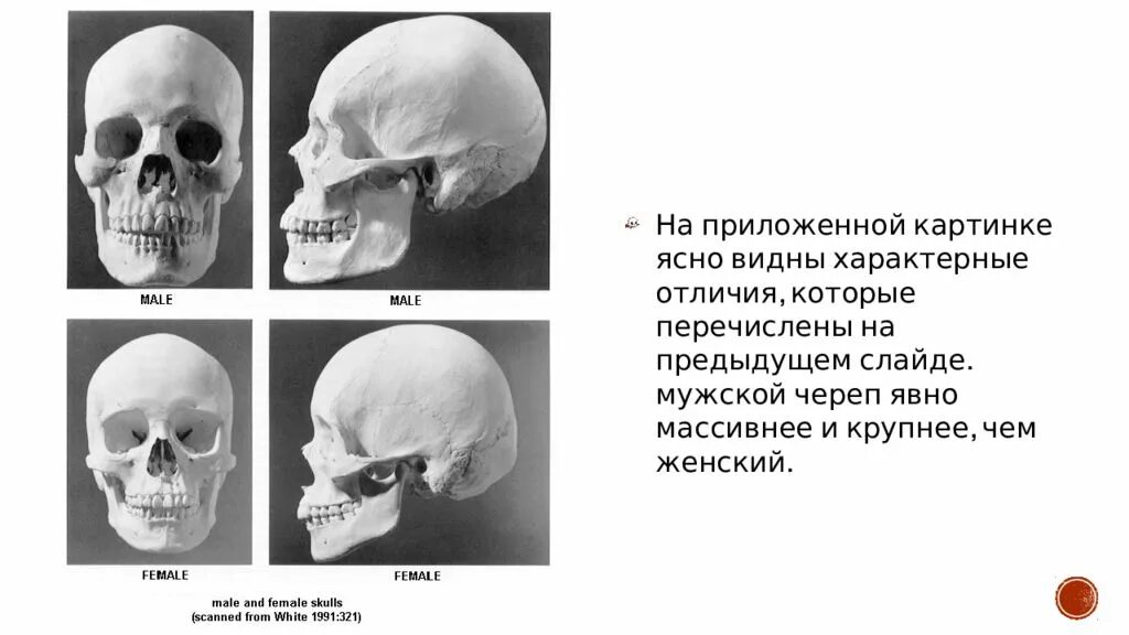 Череп мужчины и женщины. Различия черепа мужчины и женщины. Женский и мужской череп вид сбоку. Отличие мужского черепа от женского. Женский череп мужской череп.