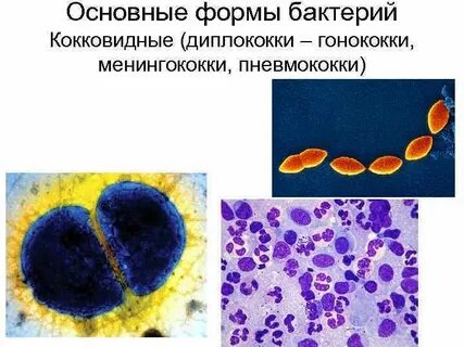 Диплококки это