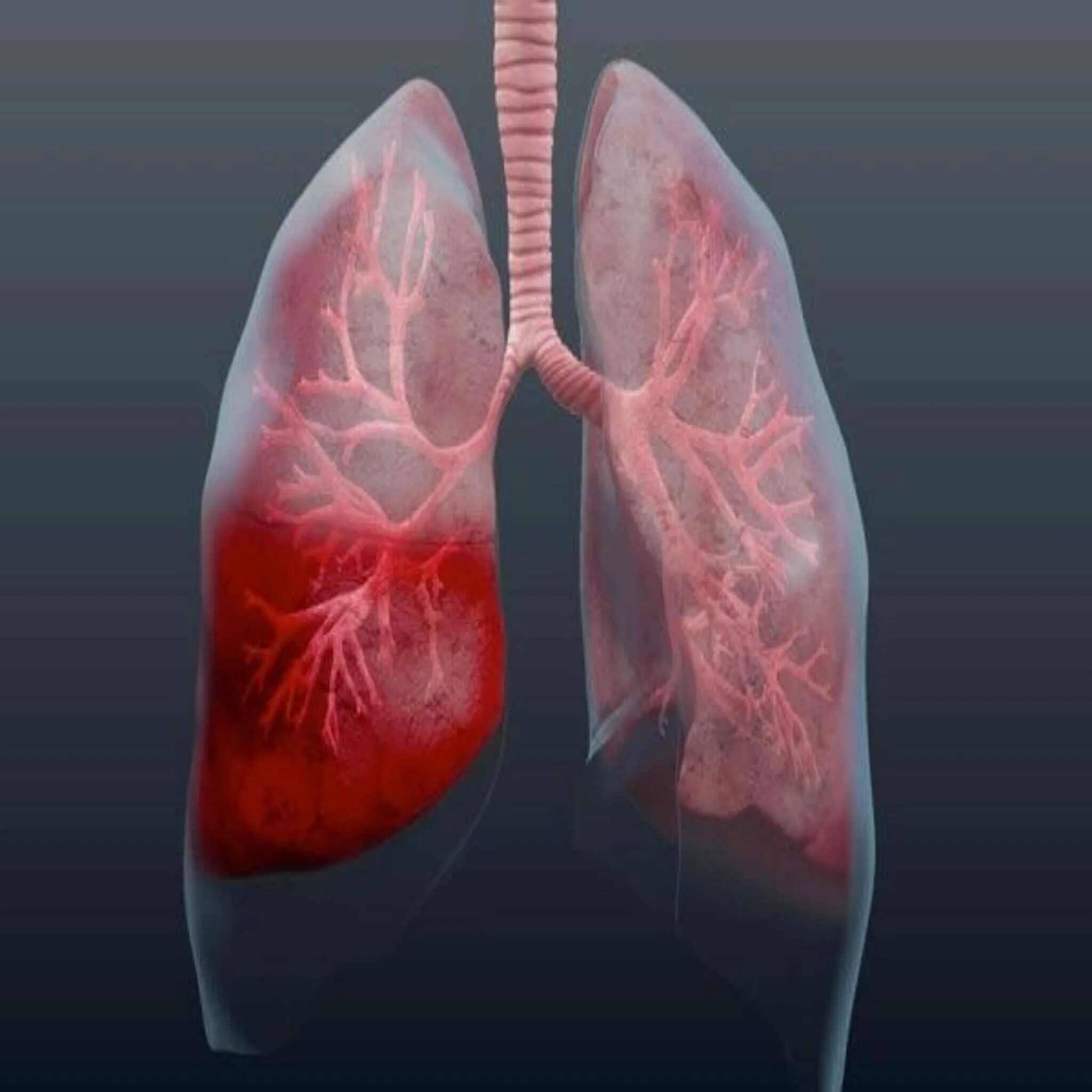 Three dimensional view of human lungs. Poster Fruugo AT