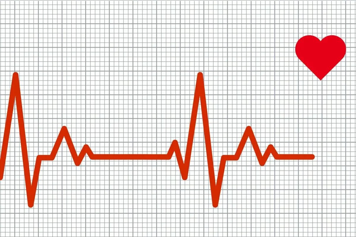 Пульс здорового человека кардиограмма. Кардиограмма сердца график. Кардиограмма сердца рисунок. Диаграмма сердцебиения.