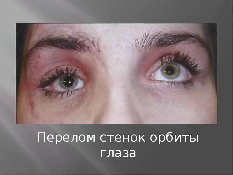 Как выглядит повреждение глаза Офтальмология педиатра общей практики Что педиатр общей