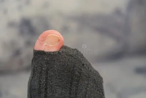 Носок на большой палец ноги
