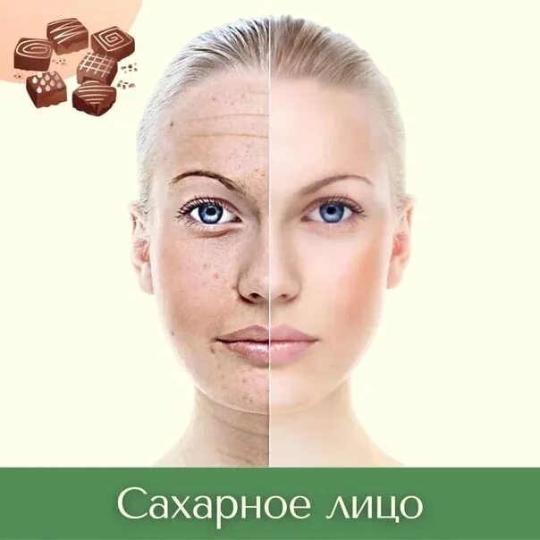 Как получить лицо сахарка. Сахарное лицо. сахарное лицо признаки. сахарное лицо винное лицо. сахарное лицо фото.
