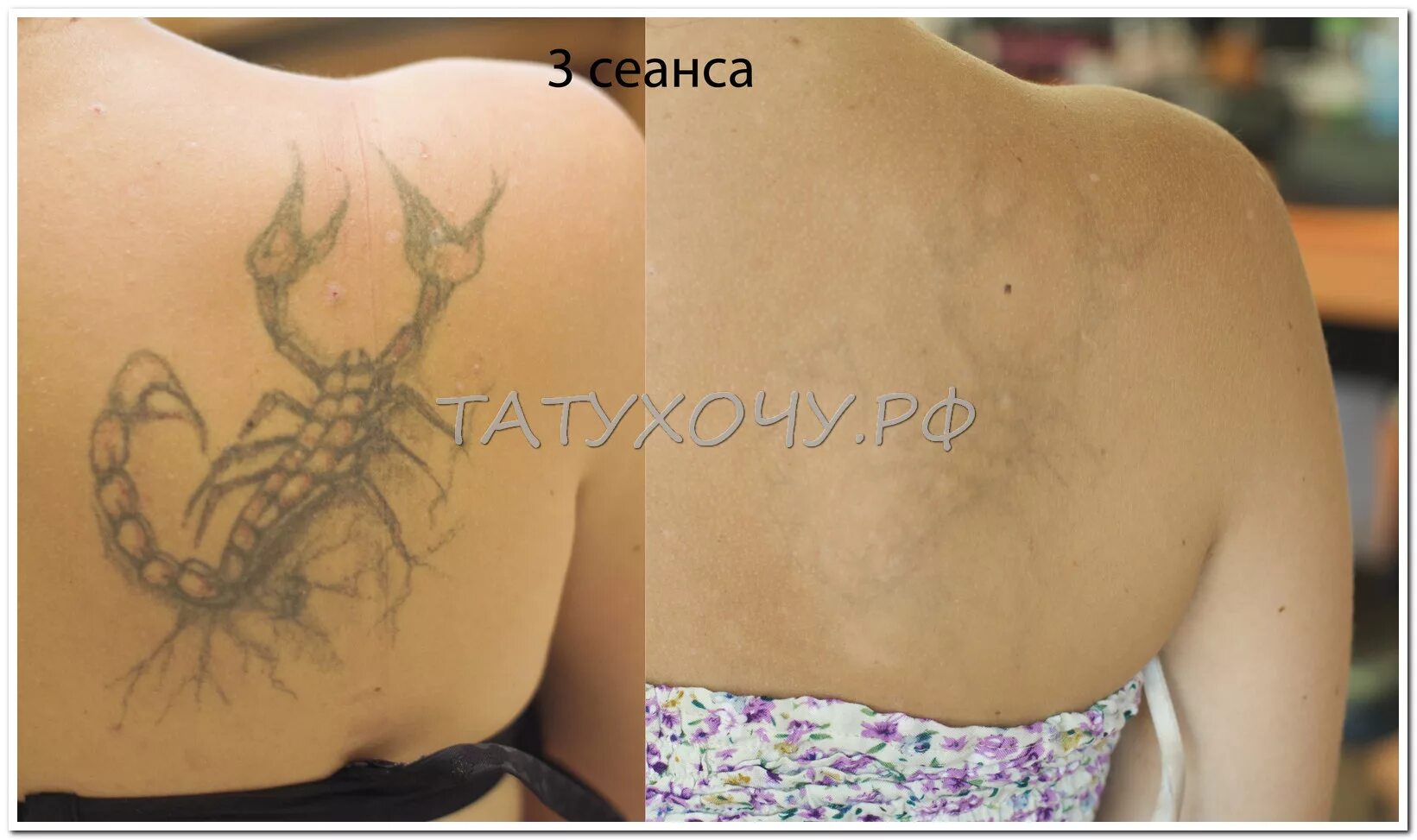 Можно ли тату. Можно ли тату