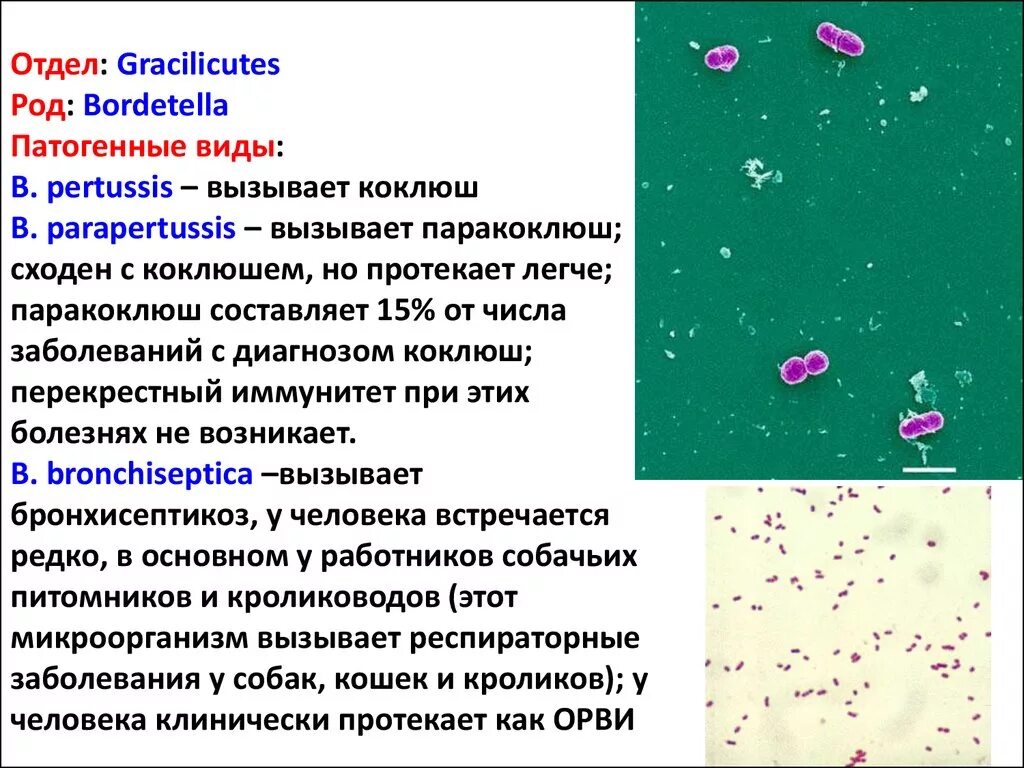 Коклюш бактериальная. Бордетеллы коклюша морфология. Возбудитель коклюша микробиология морфология. Bordetella pertussis морфология. Bordetella pertussis строение.