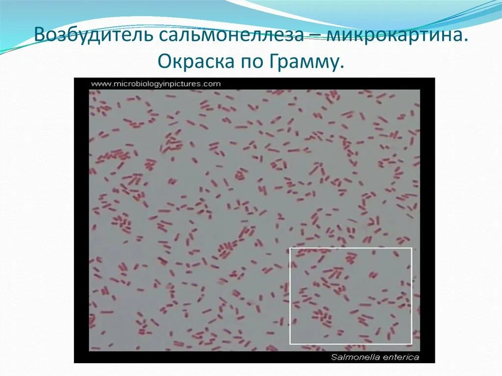 Эшерихиоз морфология. Бациллы по граму окрашиваются. E coli по граму. Сальмонелла микроскопия. Представители энтеробактерий окрашиваются по грамму.