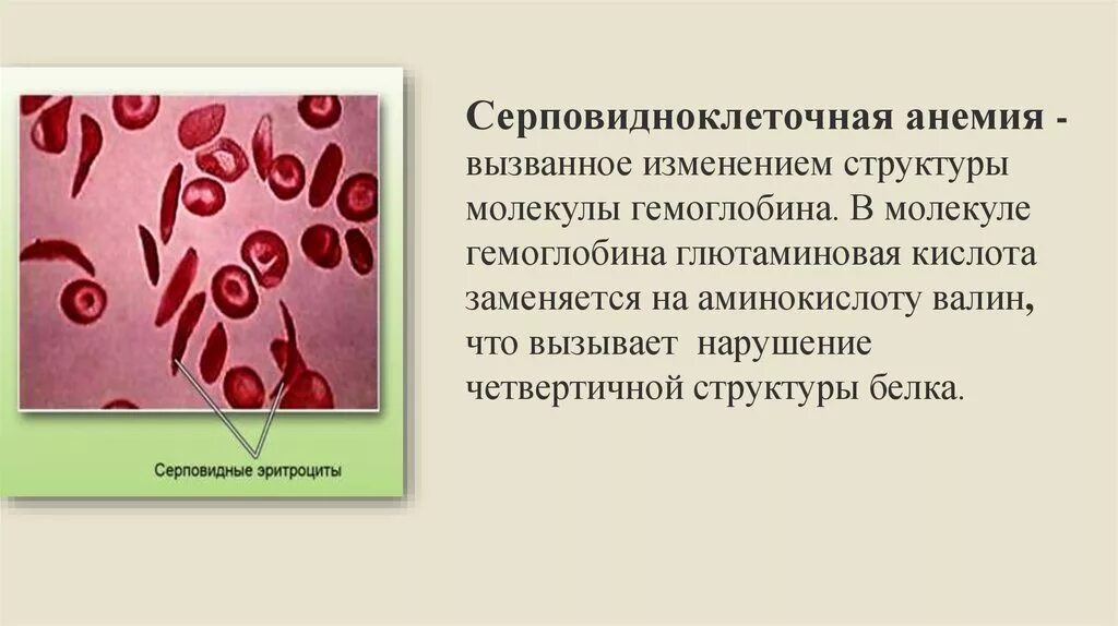 Гемоглобин серповидноклеточная анемия. Серповидноклеточная анемия структура белков. серповидноклеточная анемия и малярия. серповидноклеточная анемия аминокислоты.