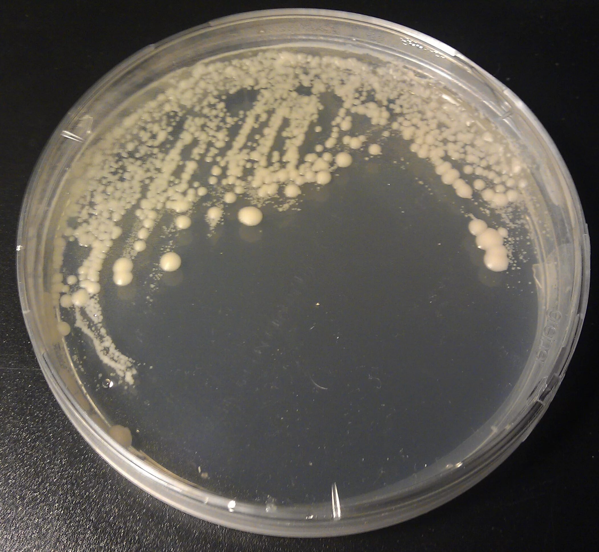 Ба агар. Saccharomyces cerevisiae на чашке Петри. Среда Сабуро микробиология. Дрожжи Brettanomyces. Агар Сабуро микробиология.