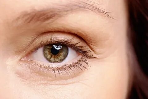 Eye gap