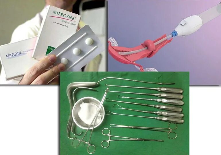 Инструменты для вакуумного аборта. Набор инструментов для вакуумного аборта. Таблетки для аборта в домашних условиях. Искусственное прерывание беременности.