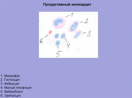 Макрофаги гистиоциты