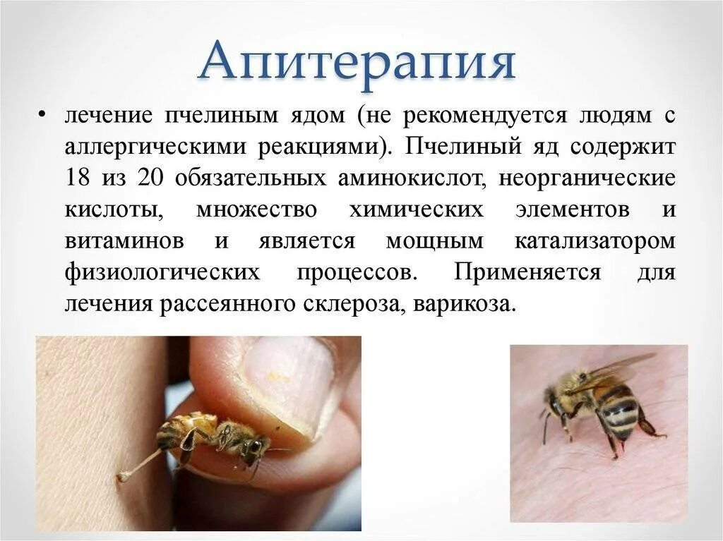 Апитерапия лечение. Апитерапия. терапия ужаливания пчелой.
