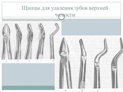 Удаление верхнего зуба элеватором