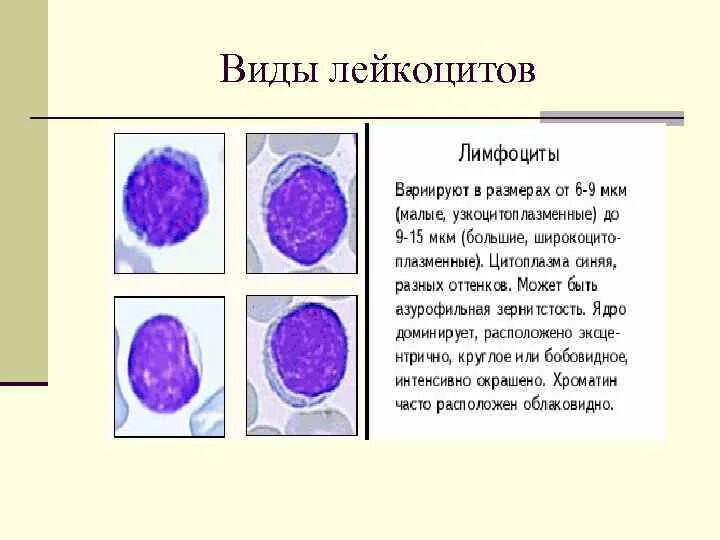 Определите виды лейкоцитов. Определите виды лейкоцитов