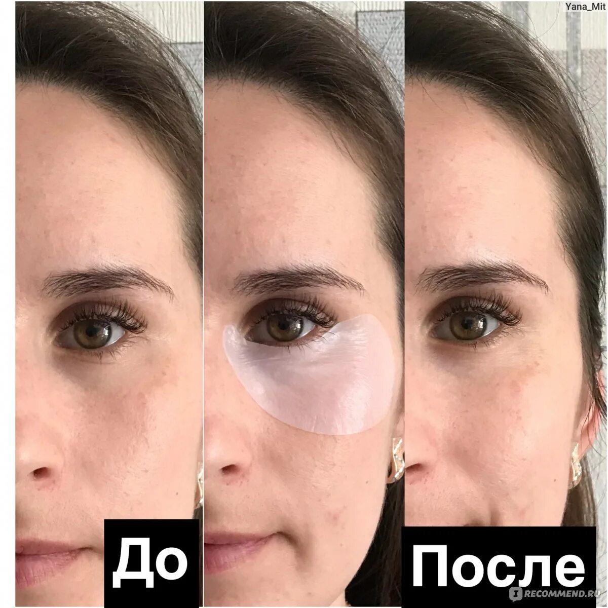 Патчи для глаз после использования. Патчи эффект до и после. патчи результат до и после. эффект до после после патчей. лицо до и после патчей.