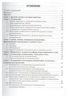 Остеохондроз неврологические проявления