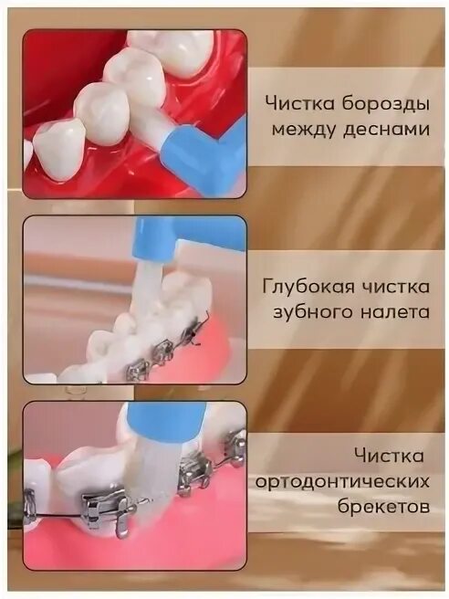 Как чистить зубы монопучковой. Щеточки для брекетов. щетка монопучковая как чистить десневой край. как чистить брекеты монопучковой щеткой.