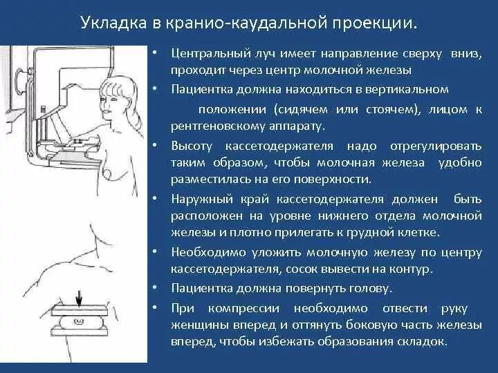 Маммография в косой проекции укладка. Укладка в краниокаудальной проекции молочной железы. Укладка молочной железы при маммографии. Укладка при маммографии в косой проекции. Каудальное направление