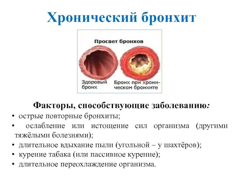 Причины частых бронхитов. Сопутствующие заболевания хронического бронхита. Зев при хроническом бронхите. Этиологические факторы вызывающие хронический бронхит. Острый катаральный бронхит.