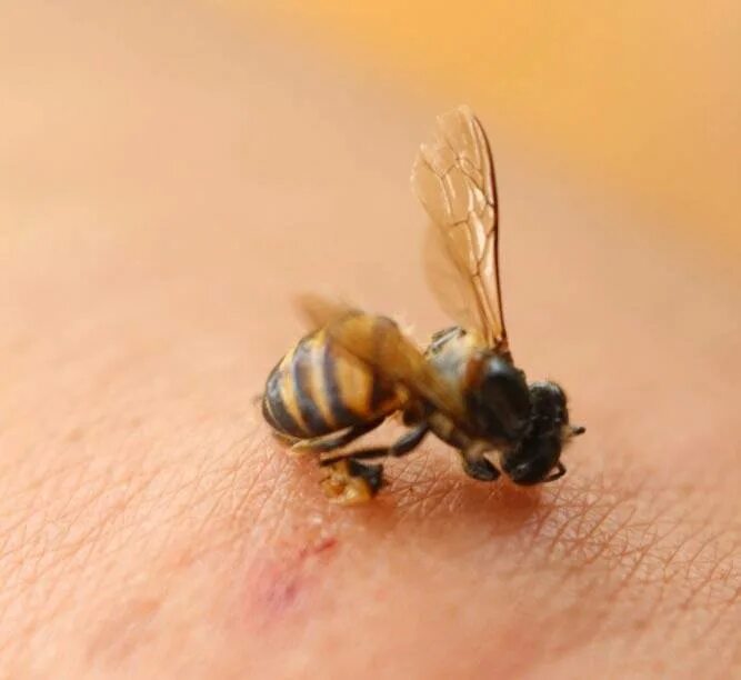 Укус пчелы человека. Шмель пчела Оса Шершень укусы.