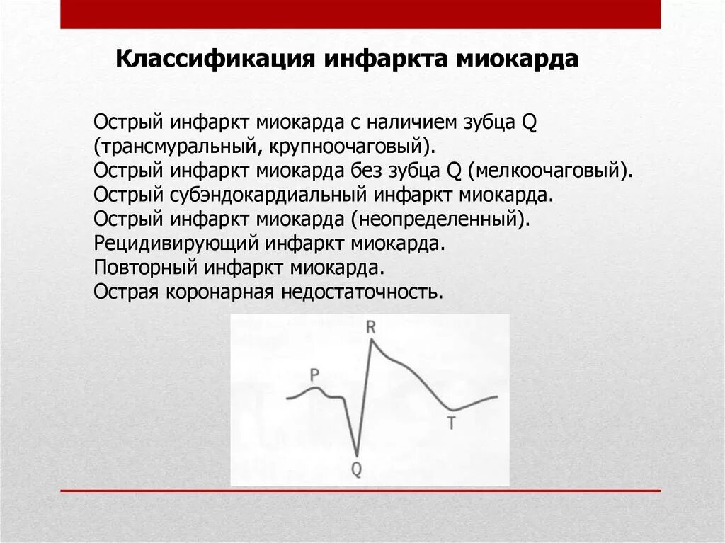 Варианты острого инфаркта миокарда