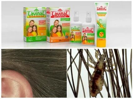 Средства от педикулеза для детей