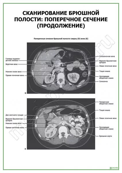 сканирование брюшной полости. кт анатомия обп. латеральный канал брюшной полости кт. сканирование брюшной полости. поперечное сечение брюшной полости.