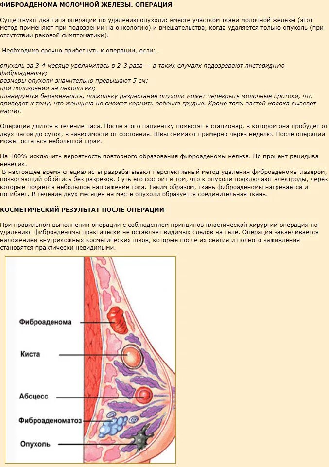 Фиброаденома молочной железы что это лечение. Фиброзно-кистозная мастопатия фиброаденома. Уплотнение в грудной железе. Опухоль в грудной железе. Уплотнения в молочных железах.