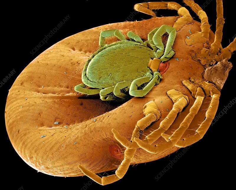 Как выглядят микробы на руках The horror under the microscope Insolite, Le monde, Insectes