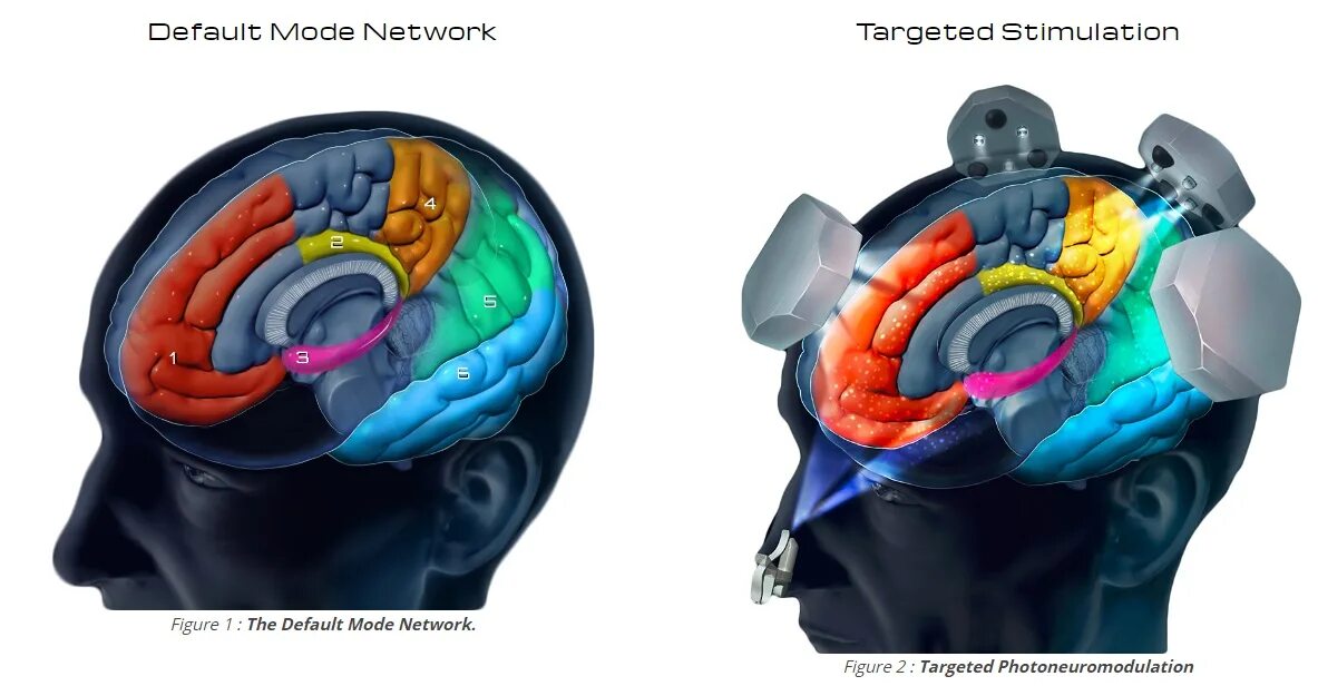 Центральная исполнительная сеть мозга. Дефолт система мозга. Маркус рейчел теория дефолт-системы мозга. Дефолт система. Default mode network.