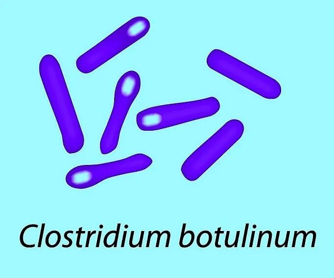 Ботулинический Токсин Clostridium botulinum. Клостридии ботулизма ( Clostridium botulinum ) ботулизм. Клостридия ботулинум анаэроб. Clostridium botulinum окраска.