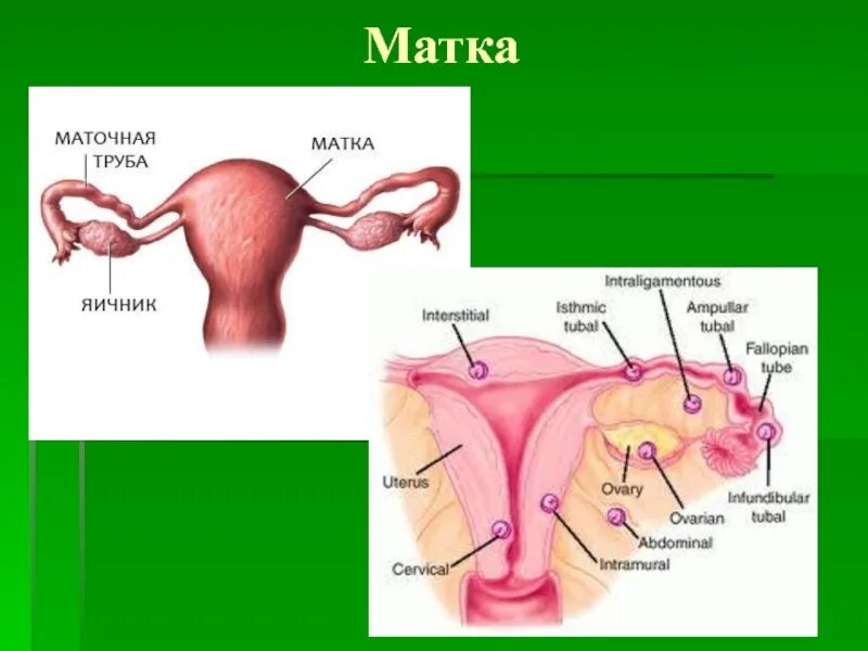 Маточные трубы. Матка и маточные трубы анатомия. Строение маточной трубы.