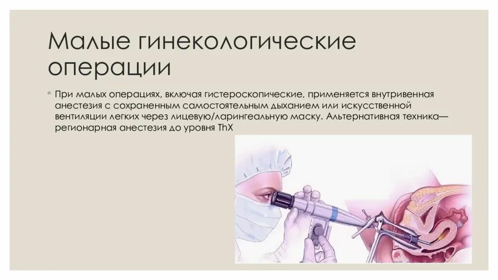 Гистероскопия в какой день цикла делать. Гинекологические операции. анестезия в гинекологии. внутривенный наркоз в гинекологии. гинекологическая операция гистероскопия.