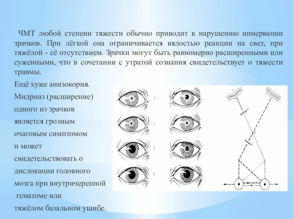 Расширение зрачка при ЧМТ. Нарушение реакции зрачков на свет. Отсутствие реакции зрачка на свет признак отсутствия