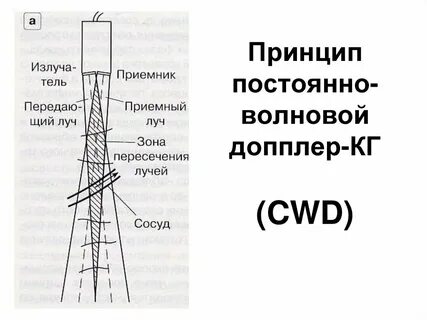 Волновой доплер
