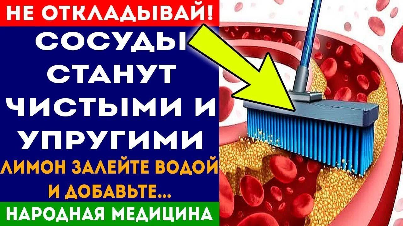 Что чистит сосуды от холестериновых. Препарат для очистки сосудов от холестерина. Препараты для чистки сосудов от холестерина. Таблетки для очистки сосудов от холестерина. Препарат для очищения сосудов от холестерина.