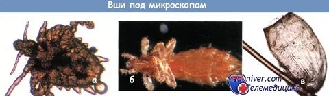 Источник педикулеза