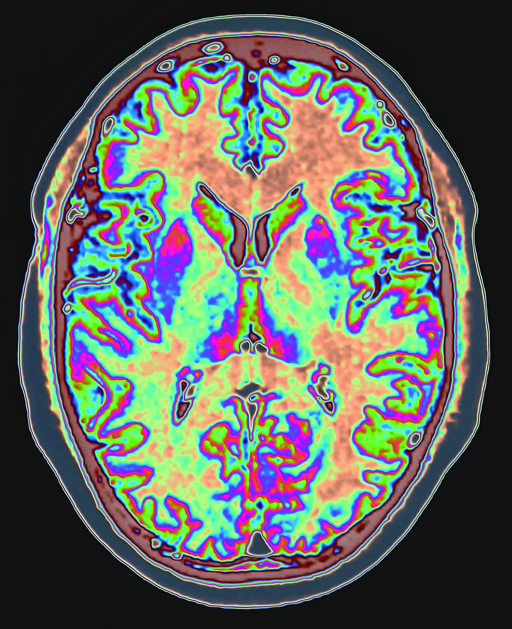 Сканирование головного мозга. Головной мозг сканограмма. Мрт мозга. Сканер мозга.
