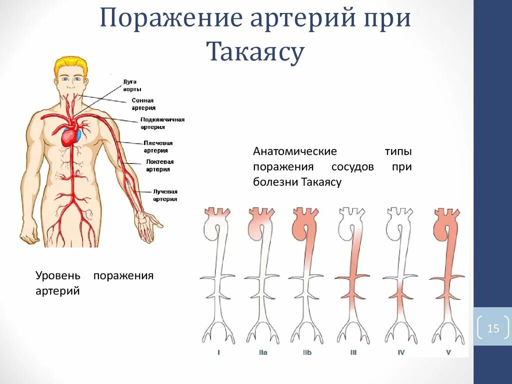 Мало поражении