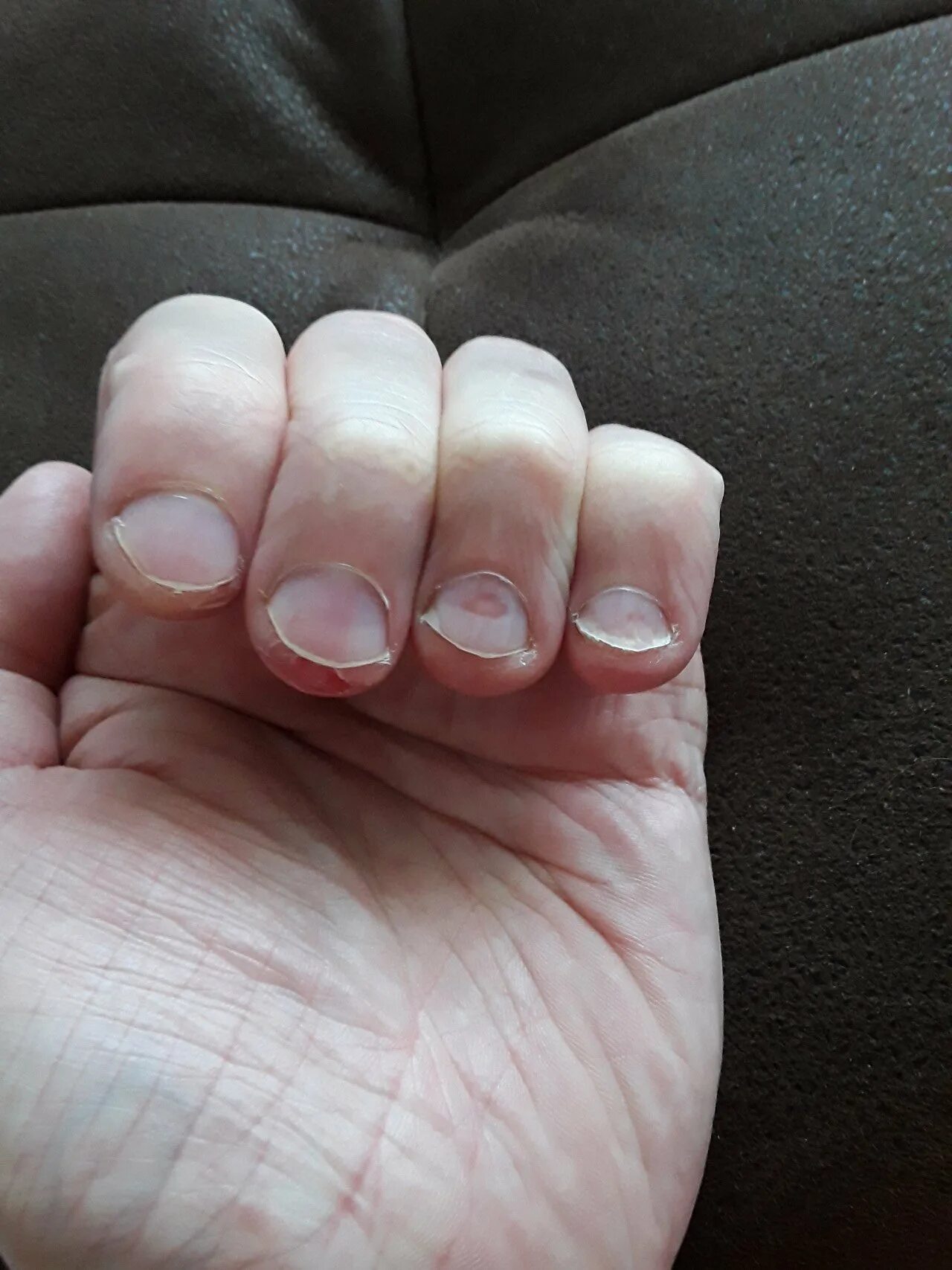 Ногти на больших пальцев мужчин. Широкие ногти. Некрасивые короткие ногти. Маникюр на короткие широкие ногти. Некрасивые широкие ногти.