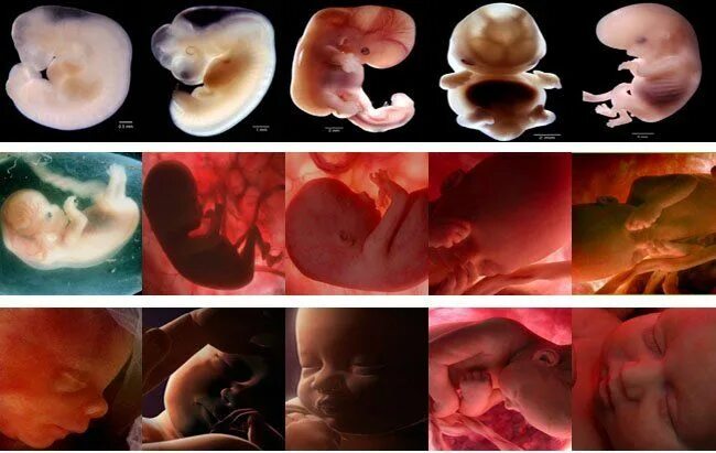 Page 5 Human embryo Vectors & Illustrations for Free Download Freepik