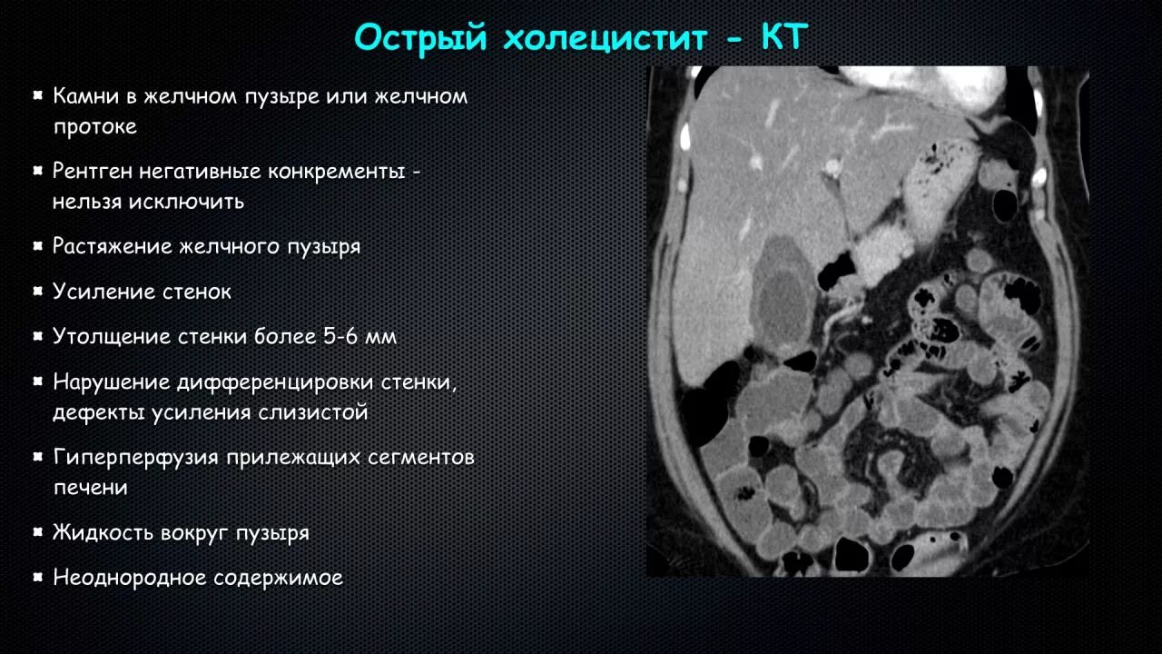 Содержимое неоднородное желчный